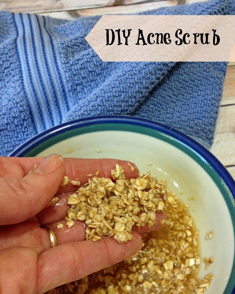 DIY Acnes Scrub Recipe 